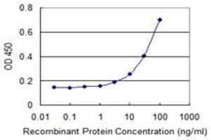 Detection limit for recombinant GST tagged SLC2A4 is 1 ng/ml as a capture antibody. (GLUT4 Antikörper  (AA 467-509))