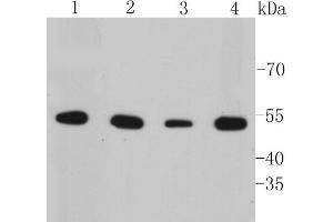 Lane 1: A549 Cell lysates, Lane 2: HepG2 Cell lysates, Lane 3: SK-BR-3 Cell lysates, Lane 4: SW1990 cell lysates, probed with Cytokeratin 7 (6E6) Monoclonal Antibody  at 1:1000 overnight at 4˚C. (Cytokeratin 7 Antikörper)