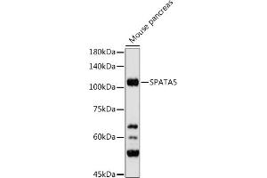 Western blot analysis of extracts of Mouse pancreas, using SP antibody (ABIN7270524) at 1:500 dilution. (SPATA5 Antikörper)