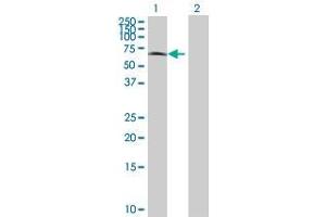 Western Blotting (WB) image for BRD3 293T Cell Transient Overexpression Lysate(Denatured) (ABIN1334035)