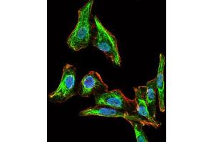 Image no. 2 for anti-Maternal Embryonic Leucine Zipper Kinase (MELK) antibody (ABIN1491623) (MELK Antikörper)