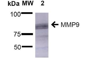 Western Blot analysis of Rat Brain showing detection of ~92 kDa and ~82 kDa (pro and active) MMP9 protein using Mouse Anti-MMP9 Monoclonal Antibody, Clone S51-82 . (MMP 9 Antikörper  (AA 1-708) (APC))