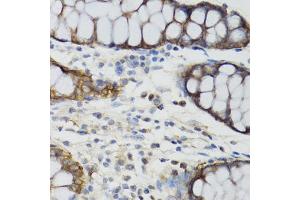 Immunohistochemistry of paraffin-embedded human rectum using GHRL antibody (ABIN6292644) at dilution of 1:100 (40x lens). (Ghrelin Antikörper)