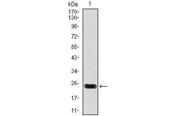 Cardiac Troponin T2 Antikörper