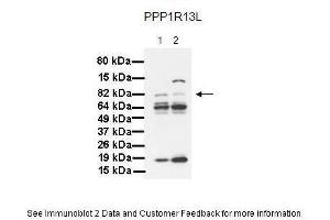 Lanes:   1. (PPP1R13L Antikörper  (Middle Region))