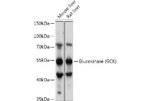 Western blot analysis of extracts of various cell lines, using Glucokinase (GCK) antibody (ABIN7267397) at 1:1000 dilution. (GCK Antikörper  (AA 250-465))