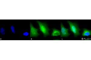 Immunocytochemistry/Immunofluorescence analysis using Rabbit Anti-SOD (Cu/Zn) Polyclonal Antibody . (SOD1 Antikörper  (Atto 594))