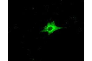 Image no. 3 for anti-Ring Finger Protein 144B (RNF144B) (AA 1-256) antibody (ABIN1490645) (RNF144B Antikörper  (AA 1-256))