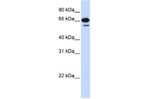 WB Suggested Anti-R3HDM2 Antibody Titration: 0. (R3HDM2 Antikörper  (Middle Region))