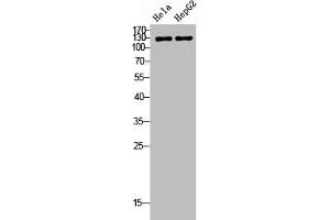 Western Blot analysis of HeLa HepG2 cells using TERT Polyclonal Antibody (TERT Antikörper  (C-Term))