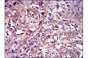 Immunohistochemistry (IHC) image for anti-CD33 (CD33) (AA 15-237) antibody (ABIN1724812)