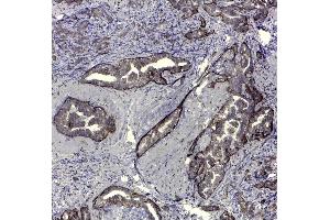 Immunohistochemistry (IHC) image for anti-CD44v5 antibody (ABIN2480453) (CD44v5 Antikörper)