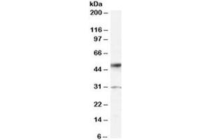 Western blot testing of human placenta lysate with ATF2 antibody at 0. (ATF2 Antikörper)
