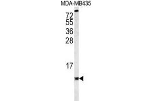 Western Blotting (WB) image for anti-Cytochrome C Oxidase Subunit VIa Polypeptide 1 (COX6A1) antibody (ABIN3004056) (COX6A1 Antikörper)