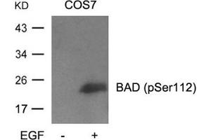 Western blot analysis of extracts from cos7 cells untreated or treated with EGF using BAD(Phospho-Ser112) Antibody (BAD Antikörper  (pSer112))