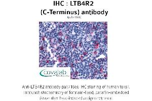 Image no. 1 for anti-Leukotriene B4 Receptor 2 (LTB4R2) (C-Term) antibody (ABIN1736595) (LTB4R2 Antikörper  (C-Term))