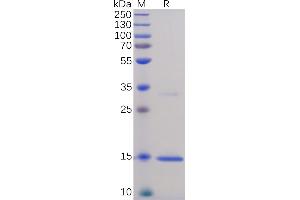 Human TNFα Protein, His Tag on SDS-PAGE under reducing condition. (TNF alpha Protein (AA 77-233) (His tag))
