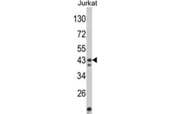 CECR5 Antikörper