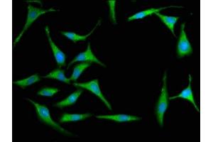 Immunofluorescence staining of Hela cells with ABIN7156645 at 1:100, counter-stained with DAPI. (MX2 Antikörper  (AA 548-688))