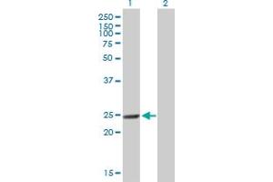 Western Blot analysis of MTHFD2 expression in transfected 293T cell line by MTHFD2 MaxPab polyclonal antibody. (MTHFD2 Antikörper  (AA 1-248))