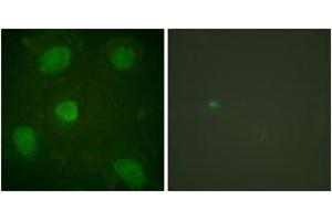 Immunofluorescence analysis of HeLa cells, using Hic-5 (Ab-60) Antibody. (TGFB1I1 Antikörper  (AA 31-80))