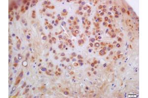 Formalin-fixed and paraffin embedded human placenta labeled with Anti-Anillin Polyclonal Antibody, Unconjugated (ABIN872314) at 1:200 followed by conjugation to the secondary antibody and DAB staining (Anillin Antikörper  (AA 501-600))