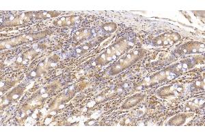Detection of IL6 in Human Small intestine Tissue using Monoclonal Antibody to Interleukin 6 (IL6) (IL-6 Antikörper  (AA 30-212))