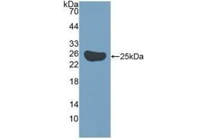 Detection of Recombinant Surv, Mouse using Polyclonal Antibody to Survivin (Surv) (Survivin Antikörper  (AA 1-140))