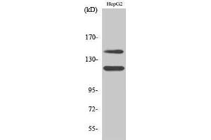 Western Blotting (WB) image for anti-Mast/stem Cell Growth Factor Receptor (KIT) (pTyr721) antibody (ABIN3179415) (KIT Antikörper  (pTyr721))
