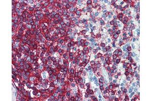 Anti-CD44 antibody IHC of human spleen. (CD44 Antikörper  (FITC))