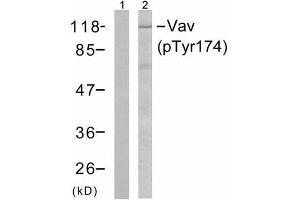 Western blot analysis of the extracts from Jurkat cells using Vav (phospho-Tyr174) antibody (E011142). (VAV1 Antikörper  (pTyr174))