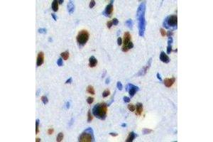 Immunohistochemistry (IHC) image for anti-RAB3A Interacting Protein (Rabin3) (RAB3IP) antibody (ABIN7308252) (RAB3IP Antikörper)