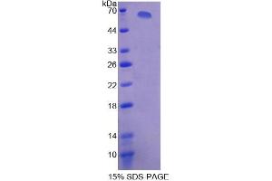 SDS-PAGE analysis of Human XDH Protein. (XDH Protein)