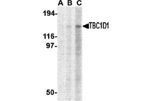 Western Blotting (WB) image for anti-TBC1 (Tre-2/USP6, BUB2, Cdc16) Domain Family, Member 1 (TBC1D1) (C-Term) antibody (ABIN1030722) (TBC1D1 Antikörper  (C-Term))