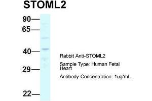 Host: Rabbit  Target Name: STOML2  Sample Tissue: Human Fetal Heart  Antibody Dilution: 1. (STOML2 Antikörper  (C-Term))