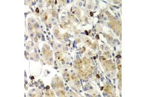 Immunohistochemistry of paraffin-embedded human stomach using MMP9 antibody (ABIN5971121) at dilution of 1/100 (40x lens). (MMP 9 Antikörper)