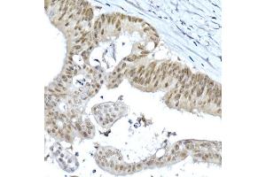 Immunohistochemistry of paraffin-embedded rat ovary using LGR5/GPR49 Rabbit pAb  at dilution of 1:300 (40x lens). (LGR5 Antikörper  (AA 824-907))