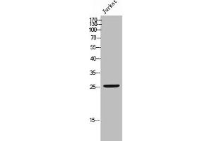 Western Blot analysis of JK cells using Phospho-Bcl-2 (S70) Polyclonal Antibody (Bcl-2 Antikörper  (pSer70))