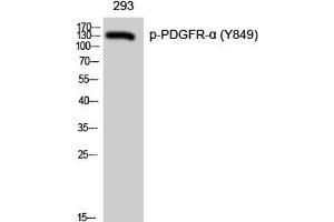 Western Blot analysis of 293 cells with Phospho-PDGFRA (Tyr849) Polyclonal Antibody (PDGFRA Antikörper  (pTyr849))