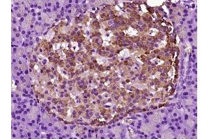 Paraformaldehyde-fixed, paraffin embedded rat pancreas tissue, Antigen retrieval by boiling in sodium citrate buffer (pH6. (ASK1 Antikörper  (pSer967))