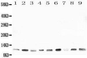 Western Blotting (WB) image for anti-Heat Shock 10kDa Protein 1 (Chaperonin 10) (HSPE1) (AA 81-102), (C-Term) antibody (ABIN3044176) (HSPE1 Antikörper  (C-Term))