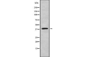 Western blot analysis of HOXC10 using Jurkat whole cell lysates (HOXC10 Antikörper  (Internal Region))