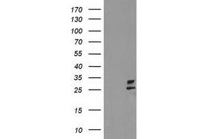 HEK293T cells were transfected with the pCMV6-ENTRY control (Left lane) or pCMV6-ENTRY CXorf26 (Right lane) cDNA for 48 hrs and lysed. (CXorf26 Antikörper)