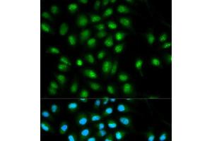 Immunofluorescence analysis of HeLa cells using ASC / TMS1 Polyclonal Antibody (PYCARD Antikörper)