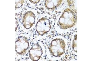 Immunohistochemistry of paraffin-embedded human colon using IFI44 antibody (ABIN5974803) at dilution of 1/100 (40x lens). (IFI44 Antikörper)