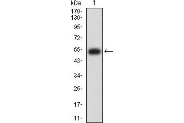 Mesothelin Antikörper  (AA 37-286)