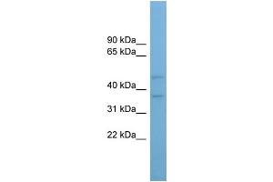 WB Suggested Anti-AADACL4 Antibody Titration: 0. (AADACL4 Antikörper  (Middle Region))