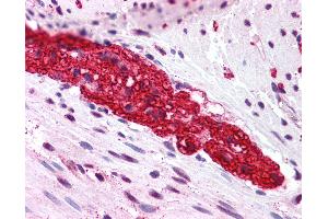 Anti-GRM5 / MGLUR5 antibody IHC of human colon, myenteric plexus. (Metabotropic Glutamate Receptor 5 Antikörper  (N-Term))