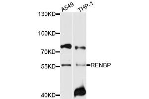 Western blot analysis of extracts of various cell lines, using RENBP antibody (ABIN6003719) at 1/1000 dilution. (RENBP Antikörper)