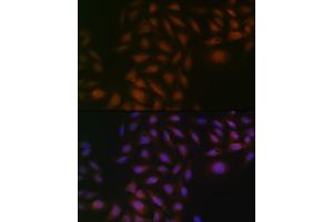 Immunofluorescence analysis of U-2 OS cells using Casein Kinase 2 beta (CSNK2B) (CSNK2B) Rabbit mAb (ABIN1680593, ABIN3019007, ABIN3019008 and ABIN7101698) at dilution of 1:100 (40x lens). (CSNK2B Antikörper)